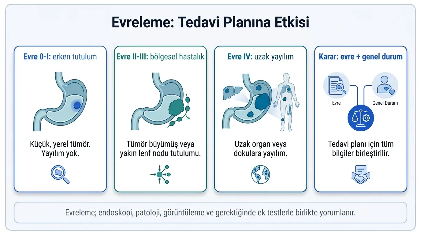 Mide kanseri evreleme infografik